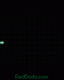ecg128x160.gif